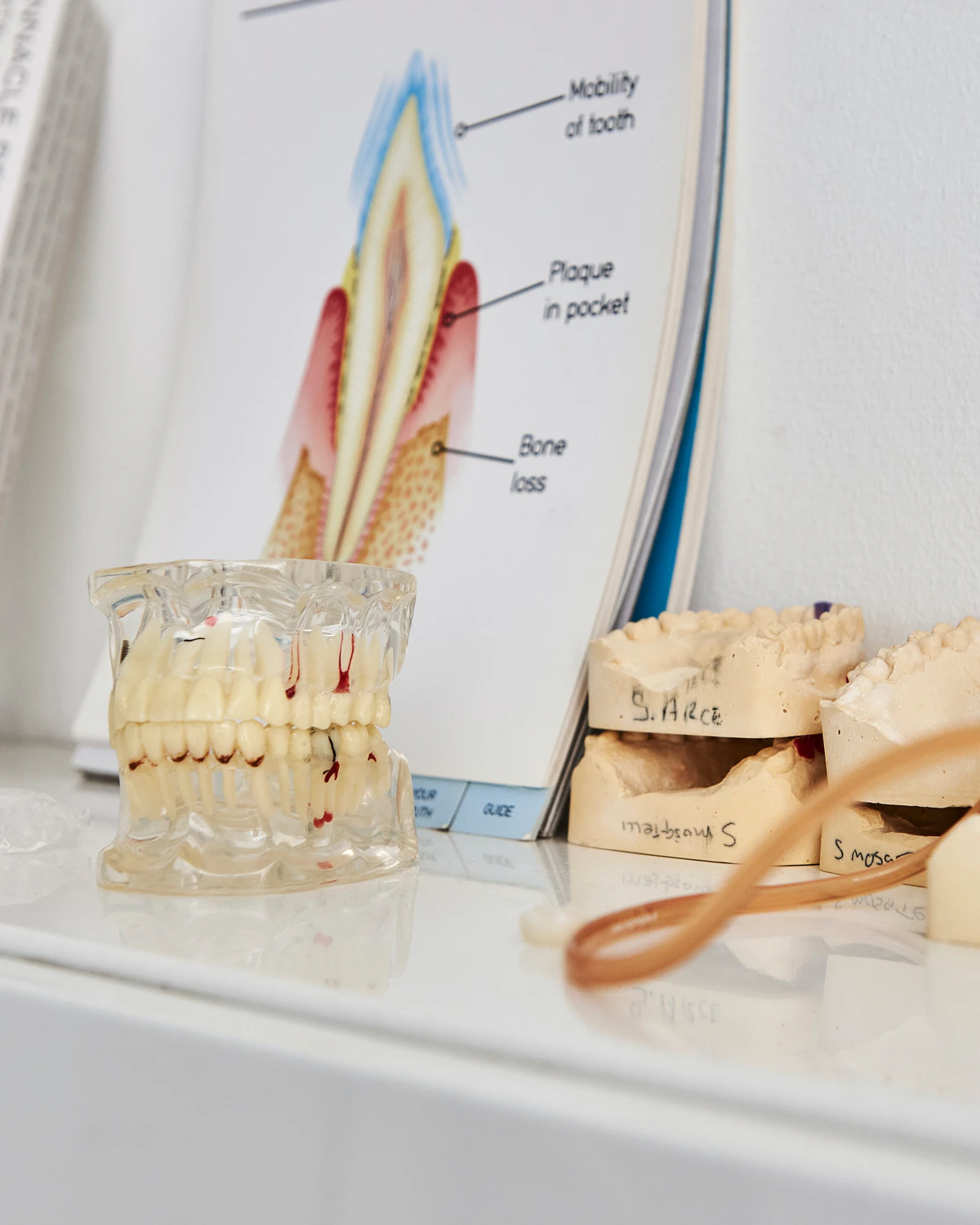 Dental crowns consultation at Keep Smiling Dental in Notting Hill